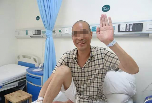 广州仁爱姚波教授用粒子刀让癌症患者看到希望